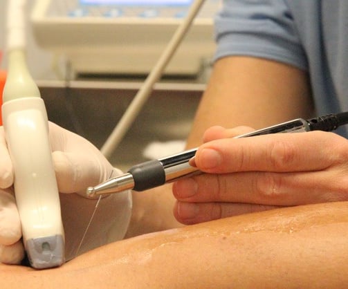 neuromodulacion fisioterapia salamanca